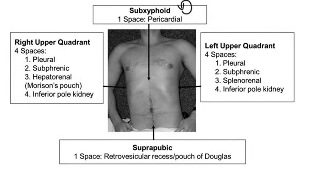 Image showing quadrants that needs to be scanned in FAST scan